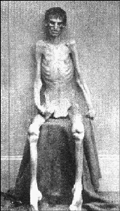 andersonville.gif (79066 bytes)